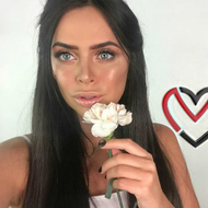Виктория Романец показала результат уколов ботокса