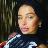 Саша Шева объяснила, почему у нее «гниет» кожа