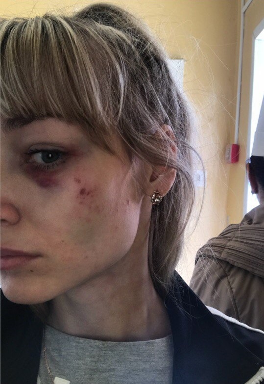 Ирина пожаловалась на жестокость бывшего избранника Фото: Соцсети