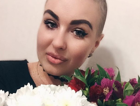 После химиотерапии Елена потеряла волосы Фото: «Инстаграм»