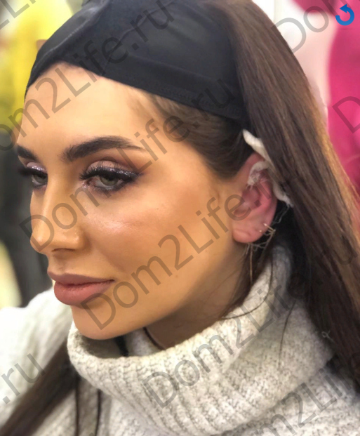 Тане уменьшили правое ухо Фото: Архив Dom2Life.ru