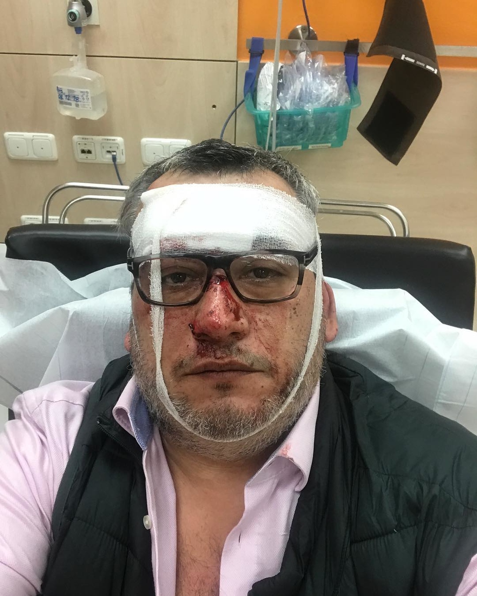 Вадим Глускер пострадал в Мюнхене.