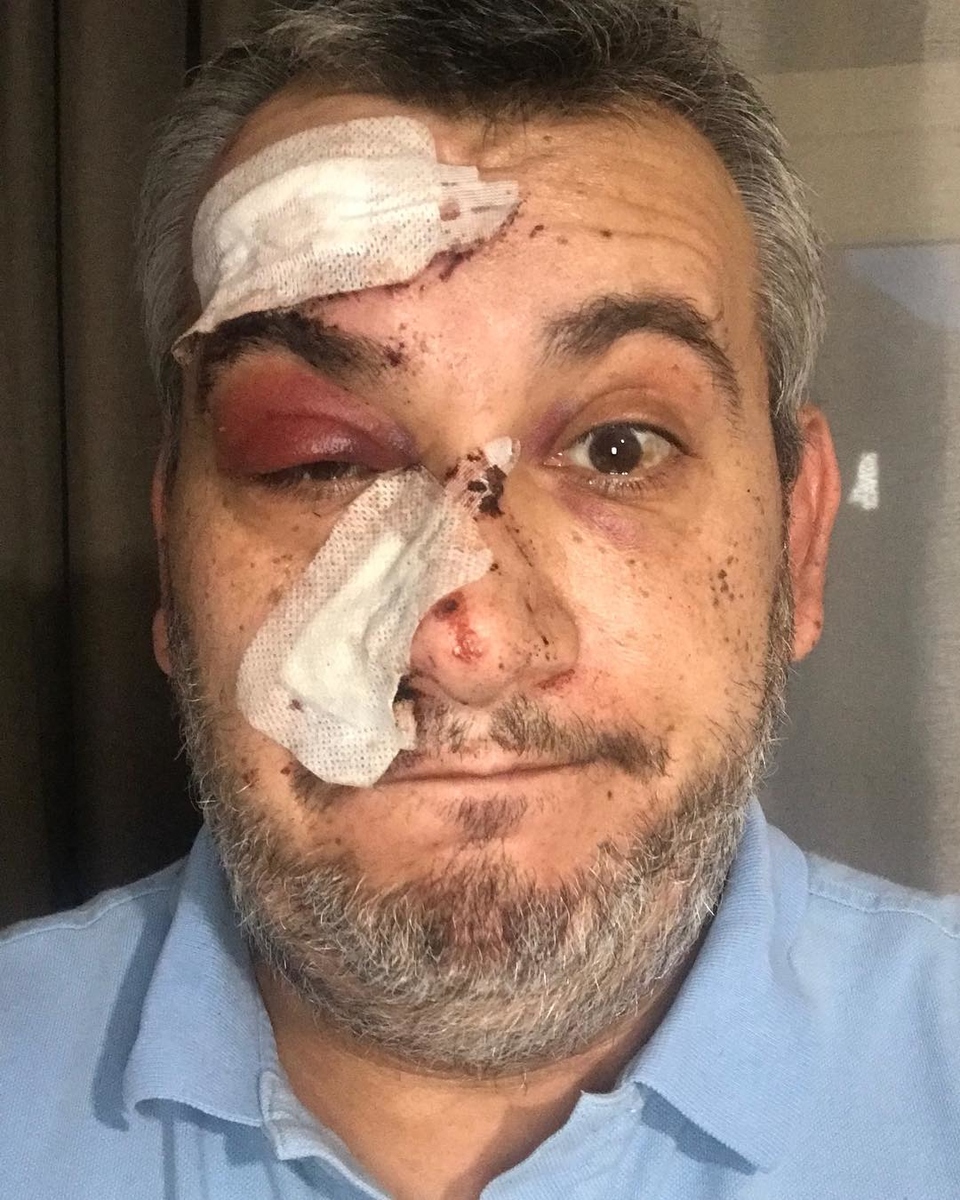 Вадим Глускер пострадал в Мюнхене.