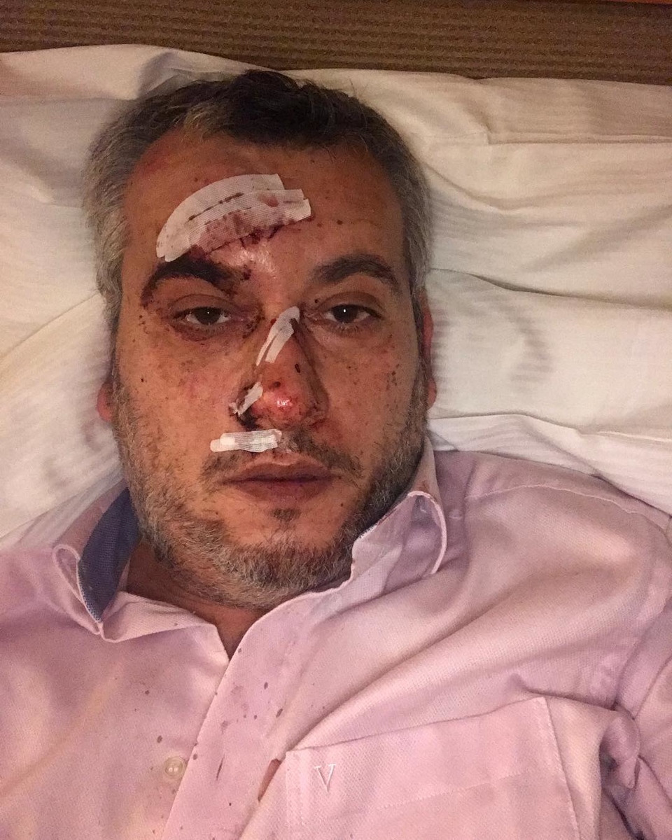 Вадим Глускер пострадал в Мюнхене.