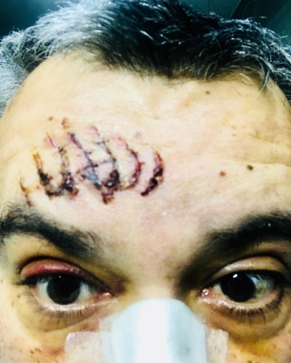 Вадим Глускер пострадал в Мюнхене.