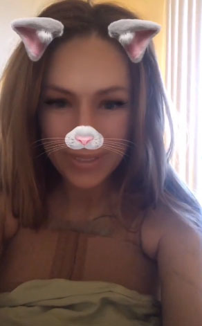 Алёна показала фото из палаты. Некоторое время она будет носить специальную повязку Фото: «Инстаграм»
