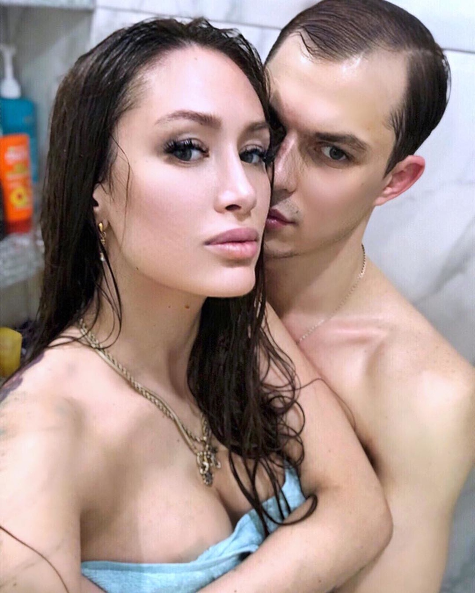 Алёна Ашмарина показала, как выглядит её грудь после операции Фото: «Инстаграм»
