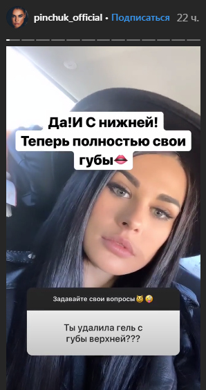Ира Пинчук вернула естесственную форму губ Фото: «Инстаграм»