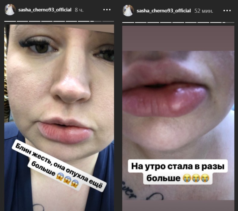 Саша боится за своё здоровье Фото: «Инстаграм»