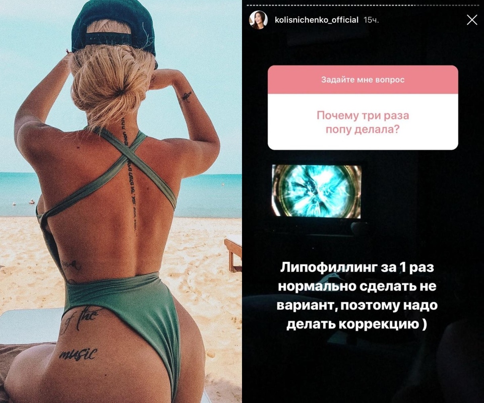 Колисниченко делала липофилинг три раза Фото: «Инстаграм»