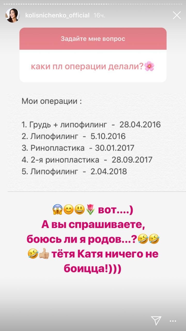 Катя Колисниченко рассказала обо всех своих пластических операциях Фото: «Инстаграм»