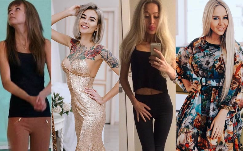 Лена Хромина во время болезни и сейчас, Маша Кохно во время болезни и сейчас Фото: «Инстаграм»