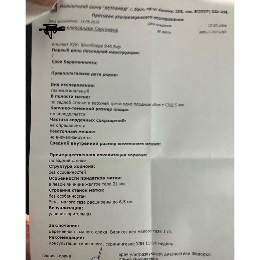 Саша продемонстрировала результаты, которые доказывают, что она была беременна Фото: «Инстаграм»