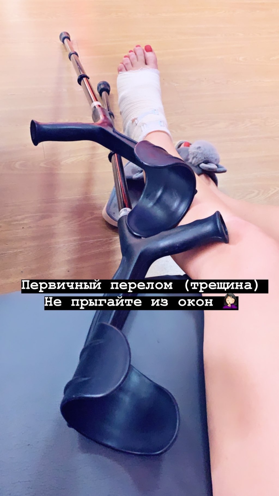 В итоге врачи диагностировали у девушки перелом Фото: «Инстаграм»