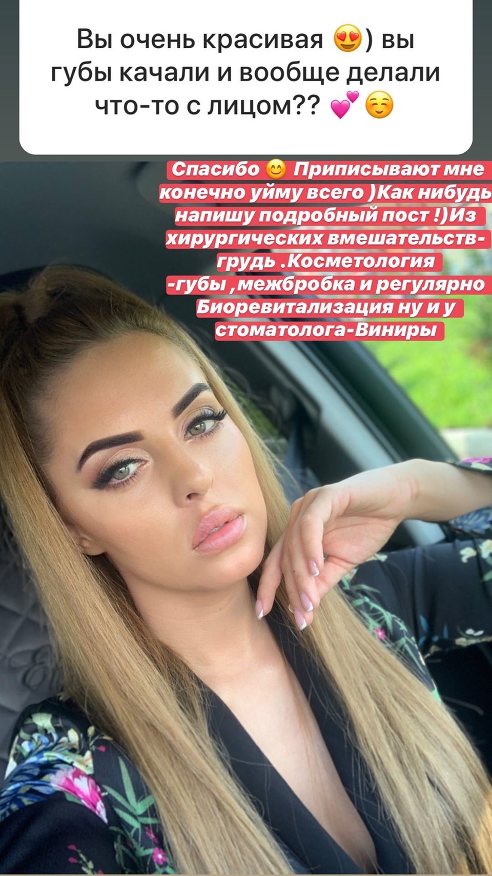 Ефременкова раскрыла правду о пластике Фото: «Инстаграм»