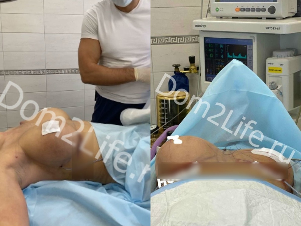 Настя показала снимок, сделанный на операционном столе Фото: Личный архив Насти Кочервей 