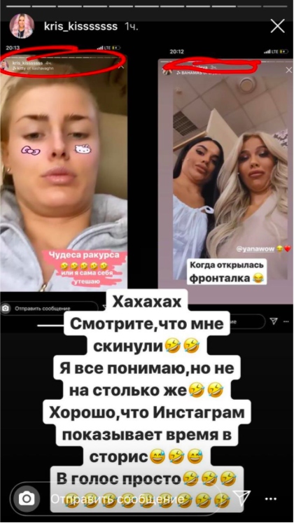 Лясковец считает, что Анита её копирует Фото: «Инстаграм»
