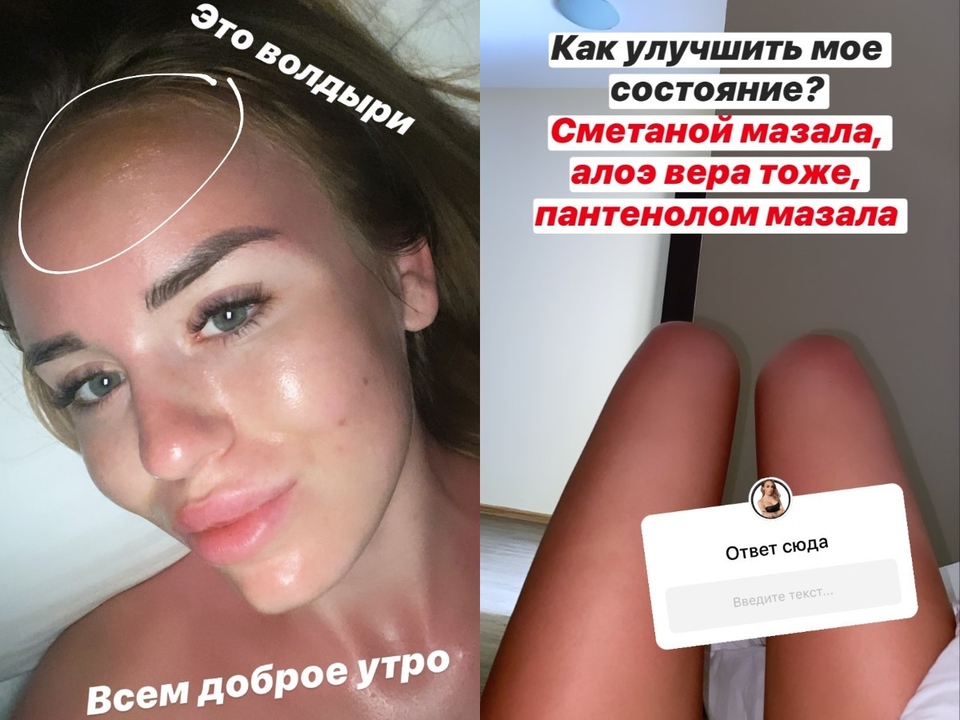 Девушка страдает от боли.