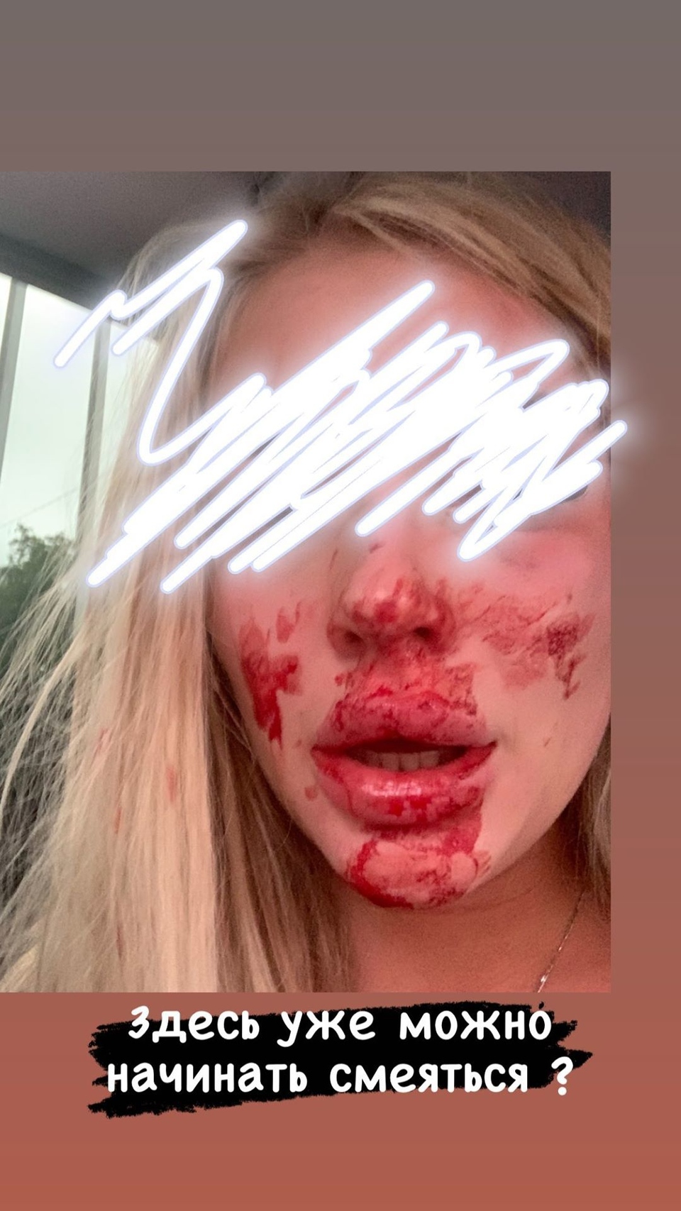 Катя показала своё окровавленное лицо Фото: «Инстаграм»