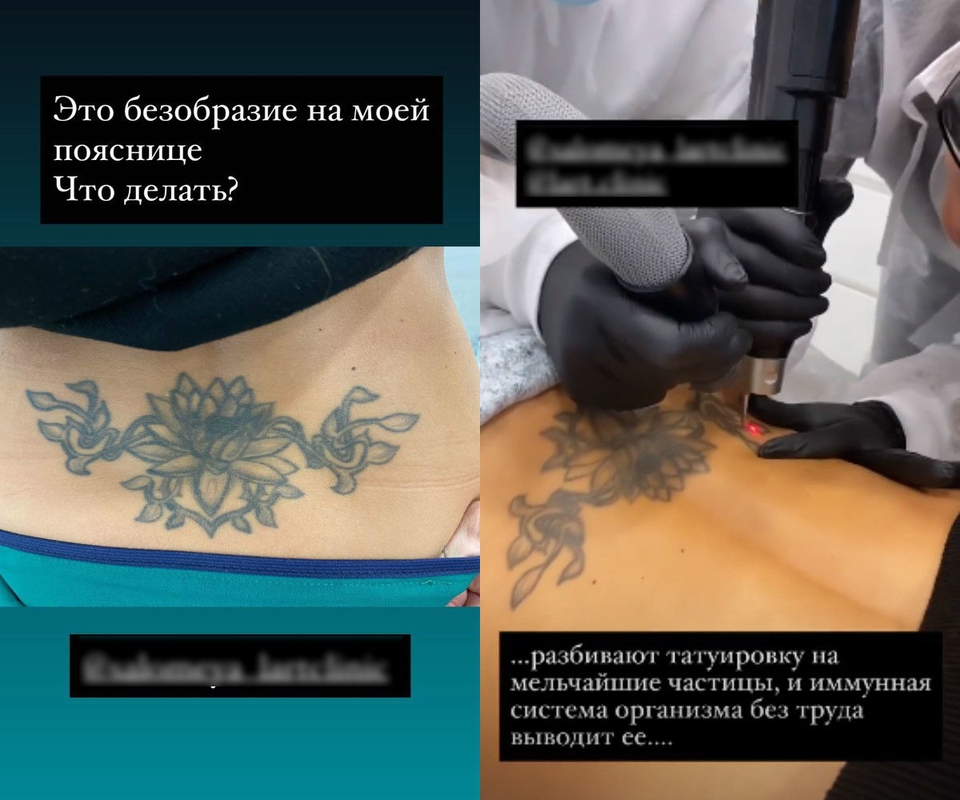 Экс-участнице разонравилось собственное тело.